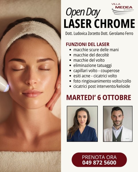 Open Day Laser Chrome 